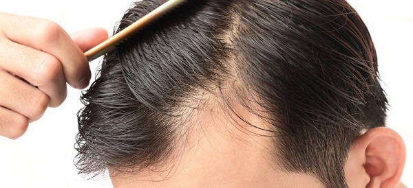 combhair